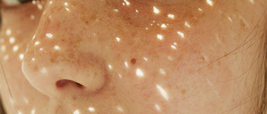 Yaz Sonrası Cilt Bakım Ritüeline Geri Dönüş